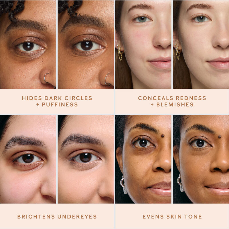 Divers probl&egrave;mes de soins de la peau sur des teints clairs, moyens et fonc&eacute;s sont pr&eacute;sent&eacute;s sous forme d'images avant et apr&egrave;s