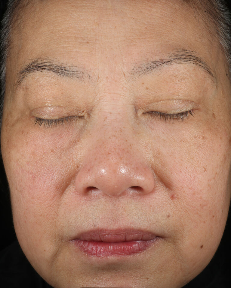 Apr&egrave;s avoir utilis&eacute; le S&eacute;rum r&eacute;g&eacute;n&eacute;rateur + C TimeWise Mary Kay dans la r&eacute;gion des sourcils